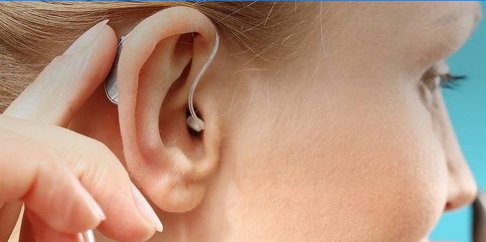 Behind-ear hearing aid in girl’s ear