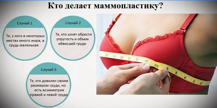 Indications for mammoplasty