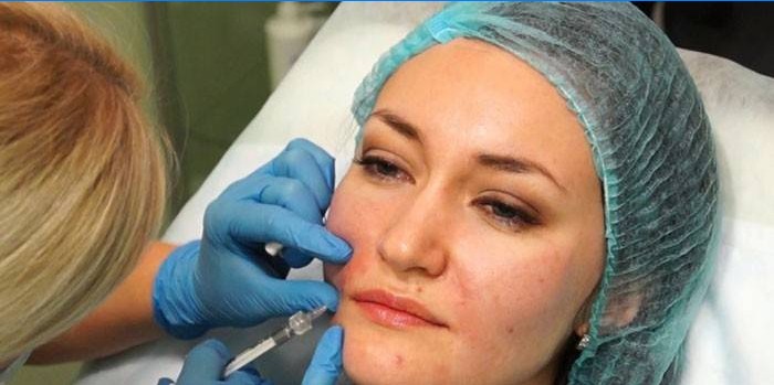 Woman gets injections in the nasolabial folds