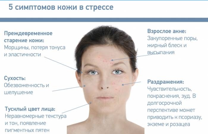 Symptoms of the skin in stress